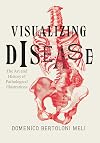 Visualizing Disease: The Art and History of Pathological Illustrations