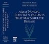 Atlas of Normal Roentgen Variants That May Simulate Disease