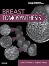 Breast Tomosynthesis, 1e