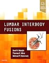 Lumbar Interbody Fusions