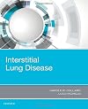 Interstitial lung disease
