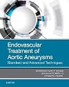 Endovascular treatment of aortic aneurysms : standard and advanced techniques