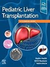 Pediatric liver transplantation : a clinical guide