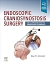 Endoscopic craniosynostosis surgery : an illustrated guide to endoscopic techniques