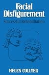 Facial Disfigurement: Successful Rehabilitation