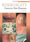 Roxburgh's Common Skin Diseases