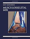 Musculoskeletal MRI