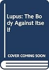 Lupus, the body against itself