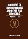 Diagnosis of onychomycosis and other nail disorders : a pictorial atlas