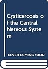 Cysticercosis of the central nervous system