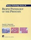 Biopsy pathology of the prostate