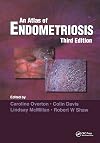 Atlas of Endometriosis (Encyclopedia of Visual Medicine Series)