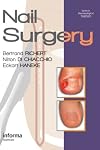 Nail surgery