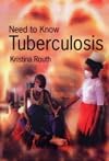 Tuberculosis (Need to Know)