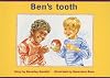 Ben's Tooth