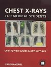 Chest X-rays for Medical Students
