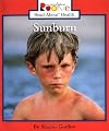 Sunburn (Rookie Read-About Health)