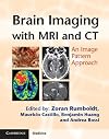 Brain imaging with MRI and CT : an image pattern approach