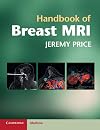 Handbook of breast MRI