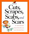 Cuts, Scrapes, Scabs, and Scars (My Health)
