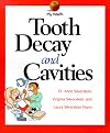 Tooth Decay and Cavities (My Health)
