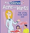 The Science of Acne and Warts: The Itchy Truth about Skin (The Science of the Body)