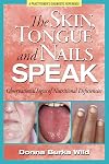 The Skin, Tongue and Nails Speak: Observational Signs of Nutritional Deficiencies