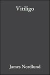Vitiligo: A Monograph on the Basic and Clinical Science