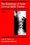 The Radiology of Acute Cervical Spine Trauma