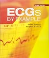 ECGs by Example, 3e