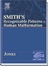 Smith's recognizable patterns of human malformation