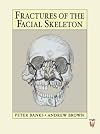 Fractures of the Facial Skeleton, 1e