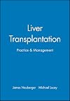 Liver Transplantation: Practice and Management