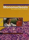 Mononucleosis (Perspectives on Disease and Illness)