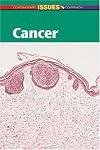 Cancer (Contemporary Issues Companion)