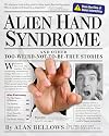 Alien Hand Syndrome