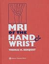 MRI of the Hand and Wrist