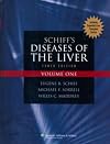 Schiff's diseases of the liver