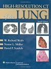 High-Resolution CT of the Lung