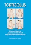 Torticollis differential diagnosis, assessment and treatment, surgical management and bracing