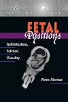 Fetal Positions: Individualism, Science, Visuality