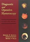 Diagnostic and Operative Hysteroscopy: A Text and Atlas