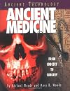 Ancient MEDICINE : From Sorcery to Surgery
