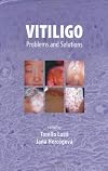 Vitiligo: Problems and Solutions