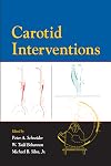 Carotid Interventions