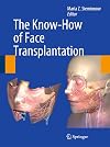 The Know-How of Face Transplantation
