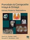 Porcelain & Composite Inlays & Onlays: Esthetic Posterior Restorations