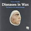 Diseases in Wax: the History of Medical Moulage