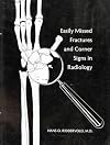 Easily Missed Fractures and Corner Signs in Radiology