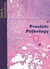 Prostate pathology